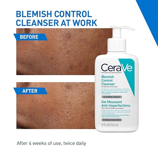 Blemish Control Cleanser 236ml