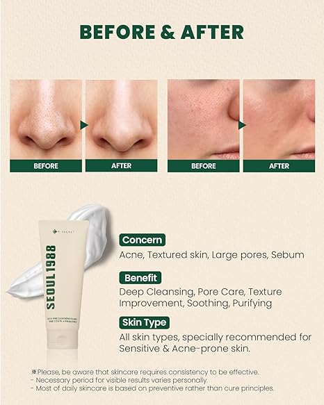 SEOUL 1988 cleansing Foam: Pine Cica 1% + Probiotics (150ml)