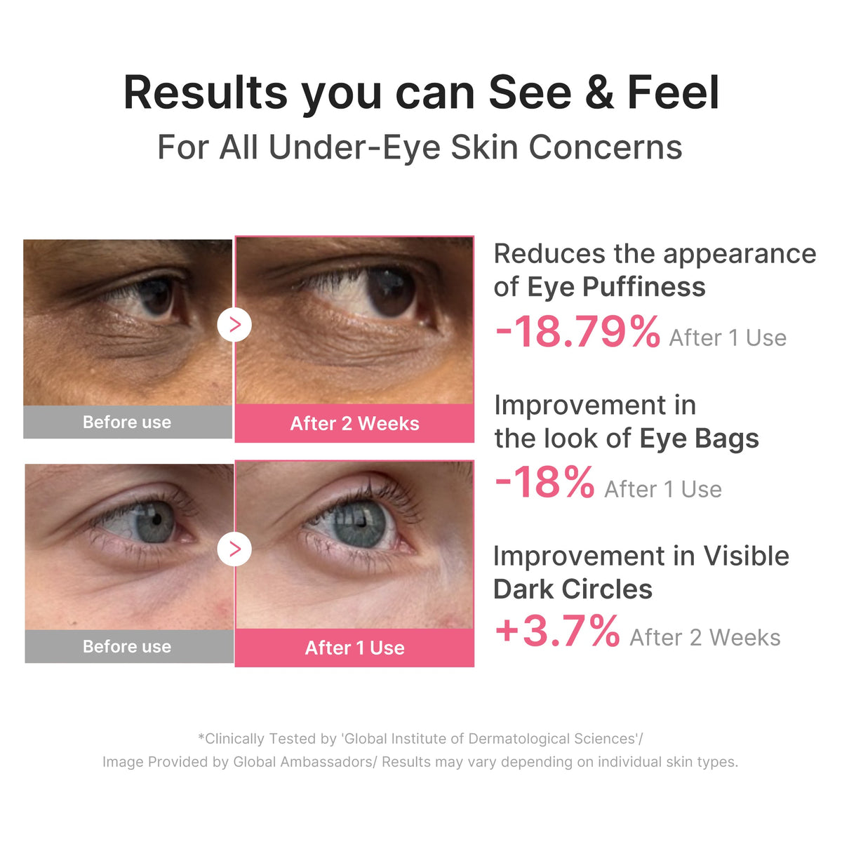 Medicube PDRN Pink Caffeine Collagen Eye Patch results for under-eye concerns