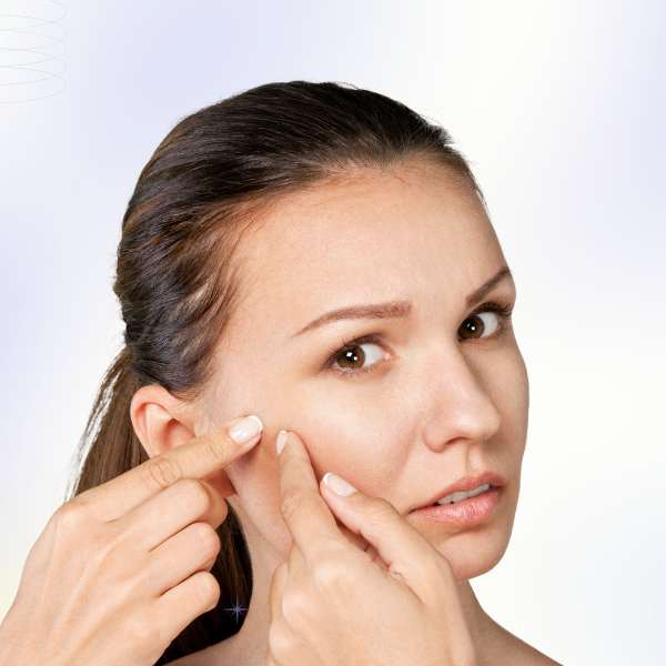 Acne Treatment