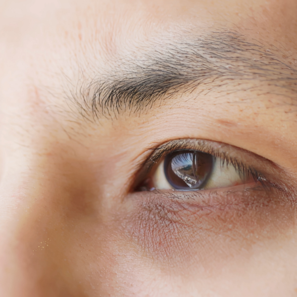 Dark Circles