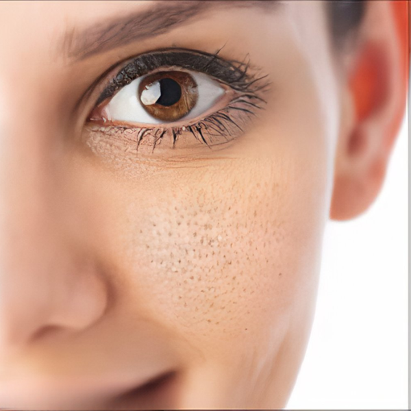 Pores