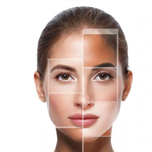 Uneven Skin Tone