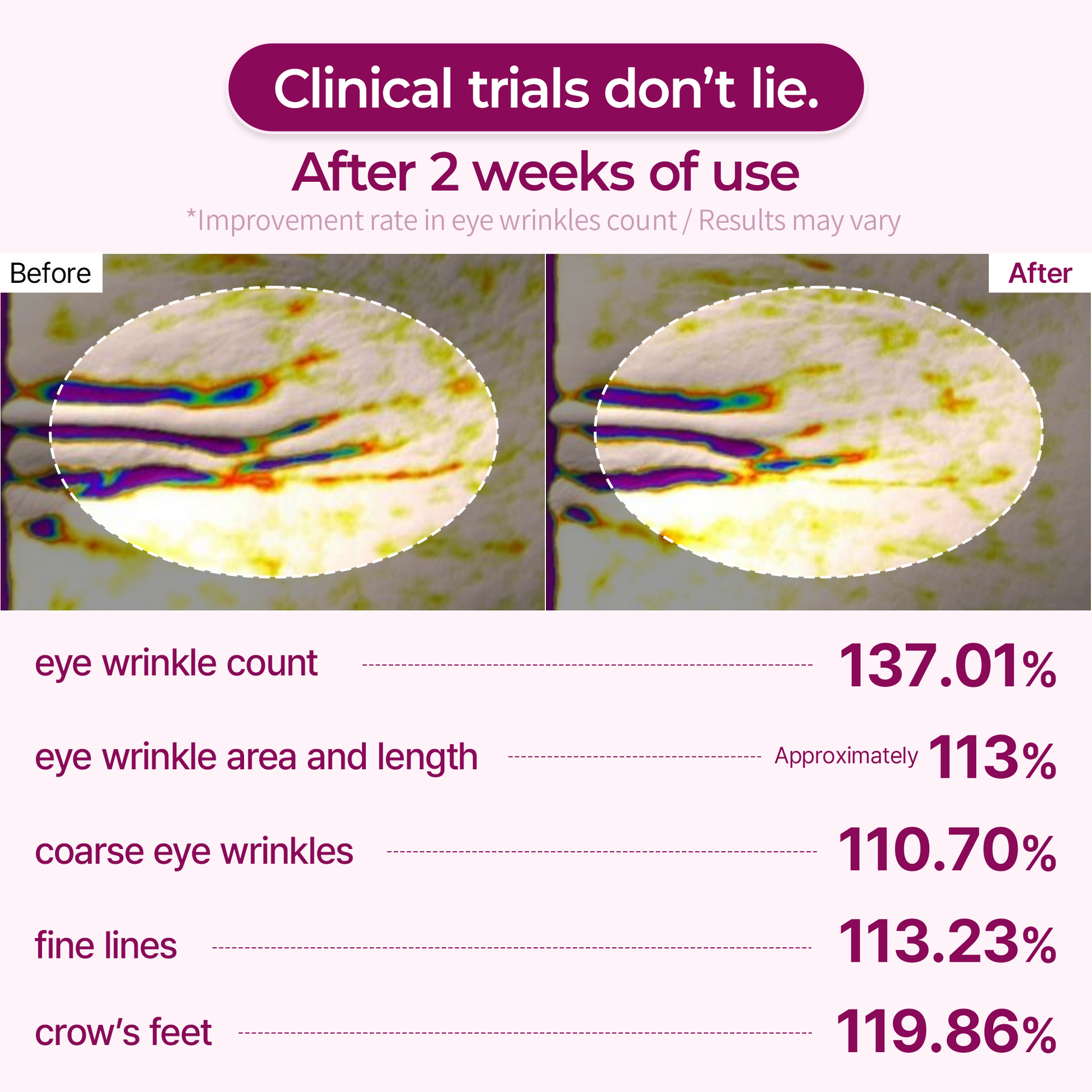 Dr.Melaxin Cemenrete Calcium Volume Eye Patch - product benefits