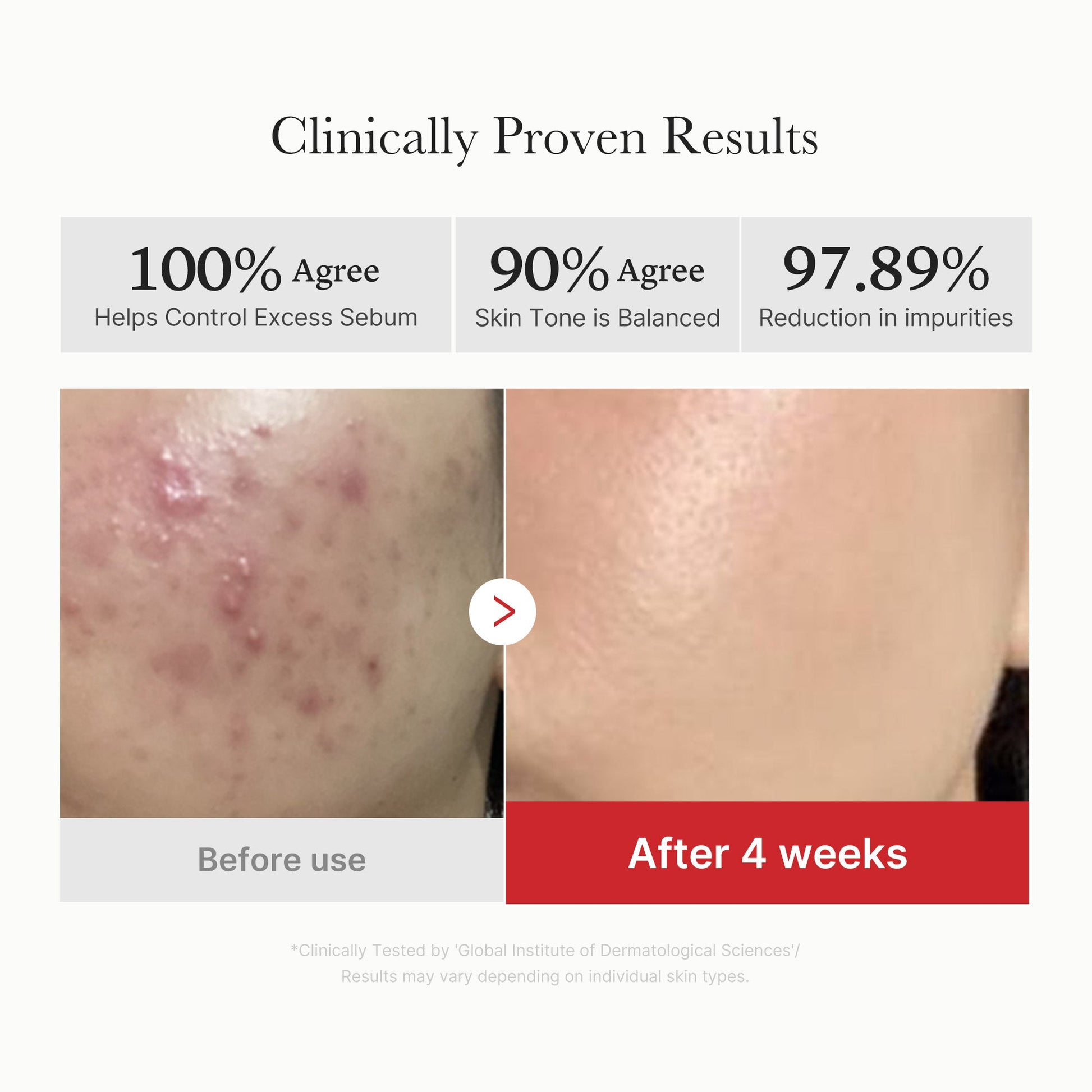 Medicube Red Succinic Acid Peeling Pad - how to use
