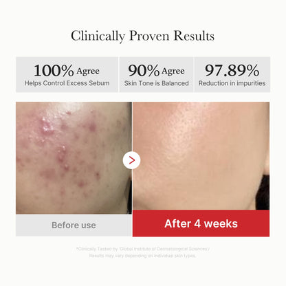 Medicube Red Succinic Acid Peeling Pad - how to use