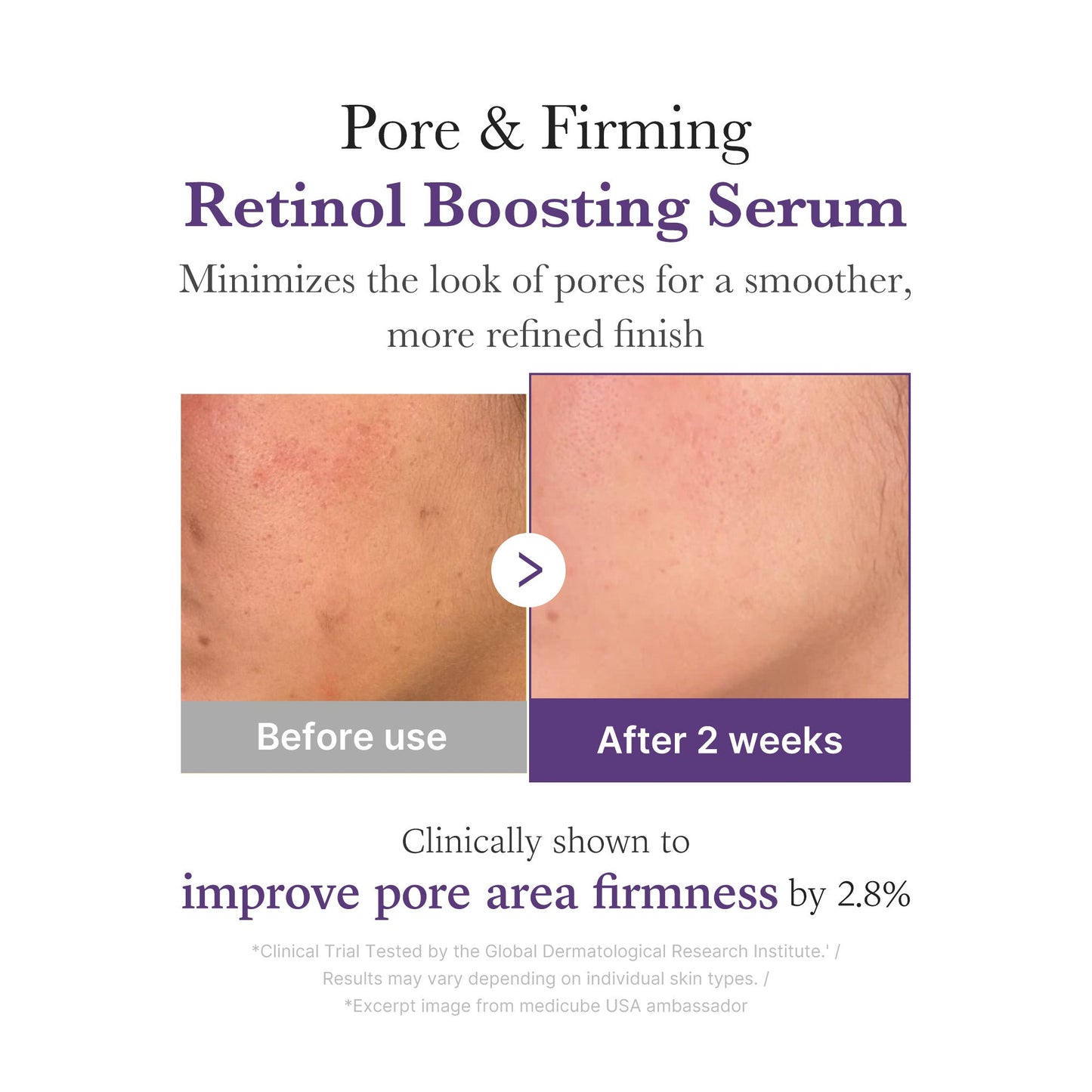 Medicube Retinol NMN Boosting Serum 4