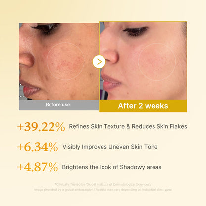 Medicube Kojic Acid Turmeric Resurfacing Toner - Clinical Study Results Before After 2 Weeks