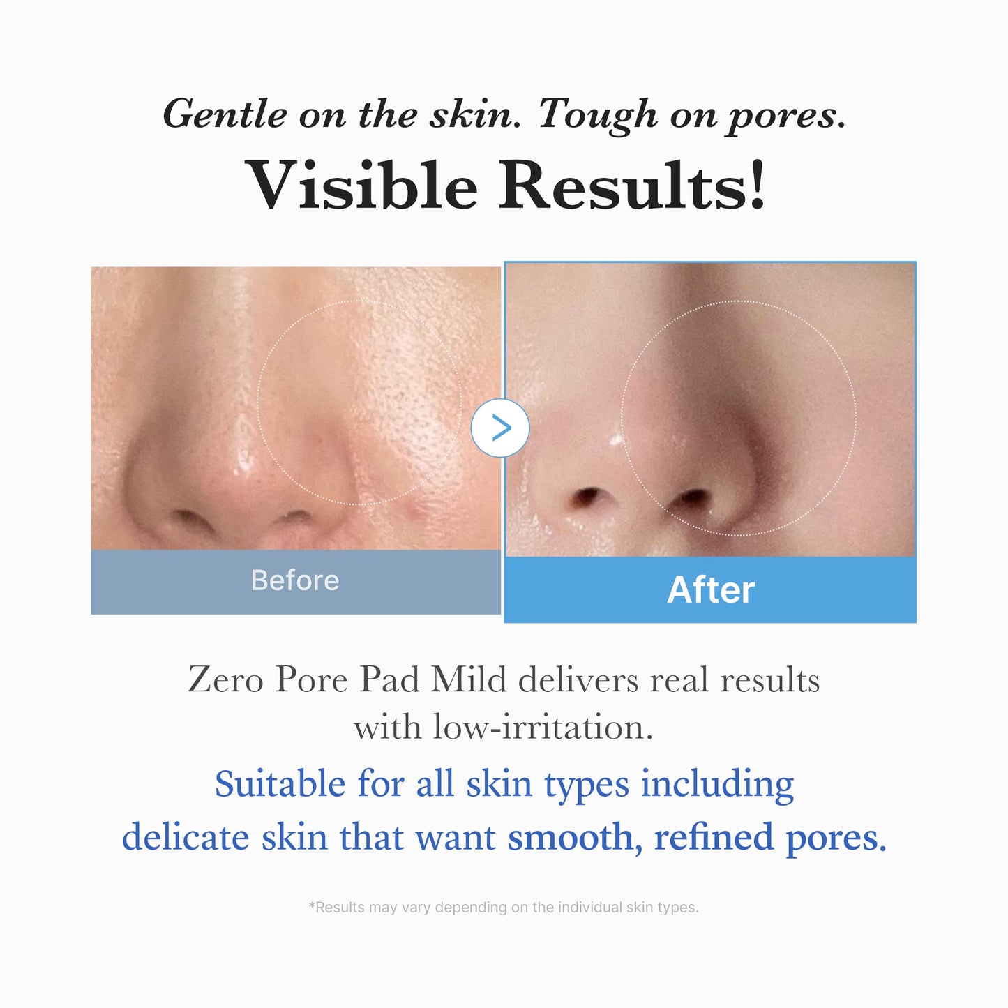 Medicube Zero Pore Pad Mild 5