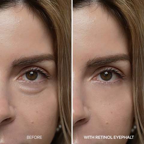 Dr. Melaxin EYEPHALT Retinol Eyebag Cream - ingredients