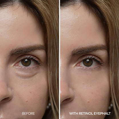 Dr. Melaxin EYEPHALT Retinol Eyebag Cream - ingredients