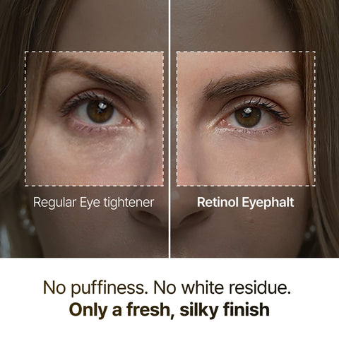 Dr. Melaxin EYEPHALT Retinol Eyebag Cream - key benefits