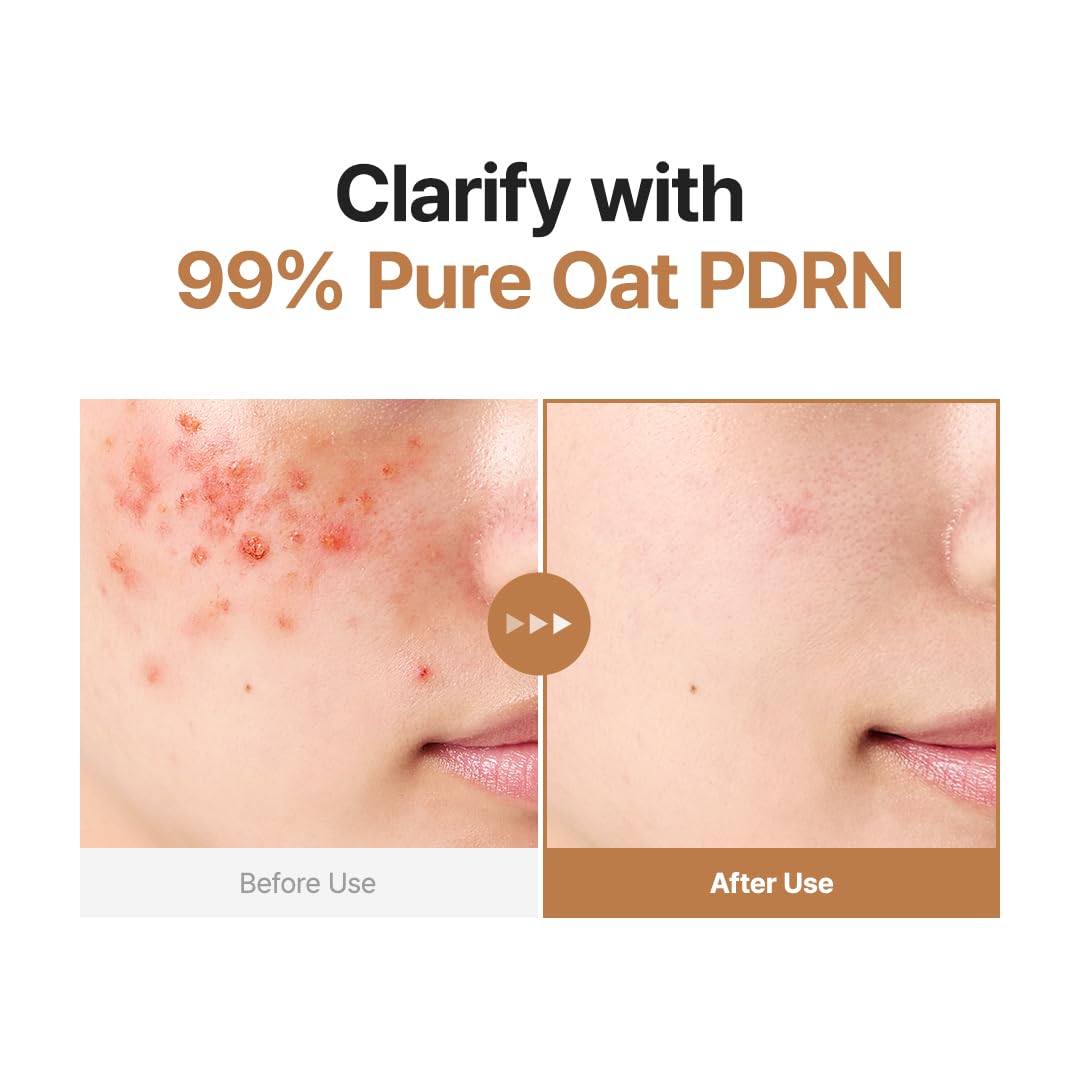 Purito Seoul Oat PDRN Gentle Refining Toner 200 mL