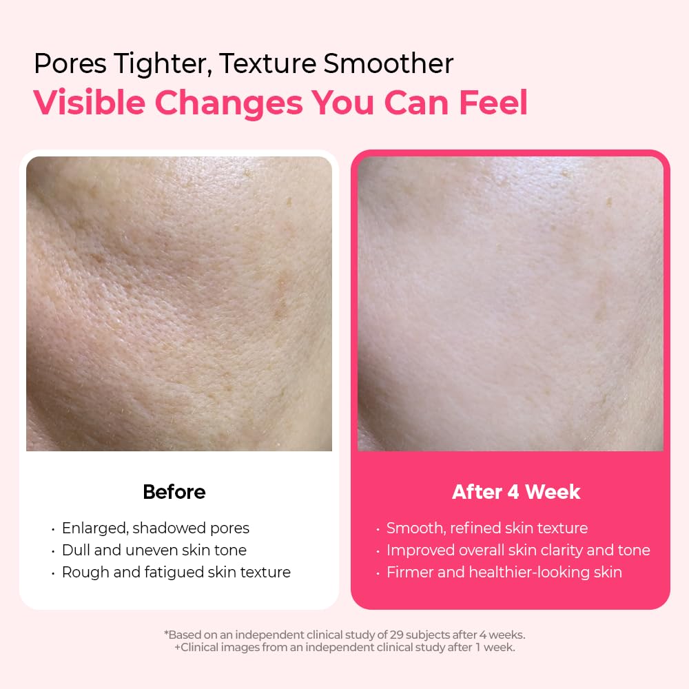 Cemenrete Cyano Pink Spicule Serum – 30ml