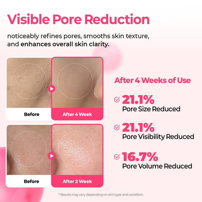Cemenrete Cyano Pink Spicule Serum – 30ml