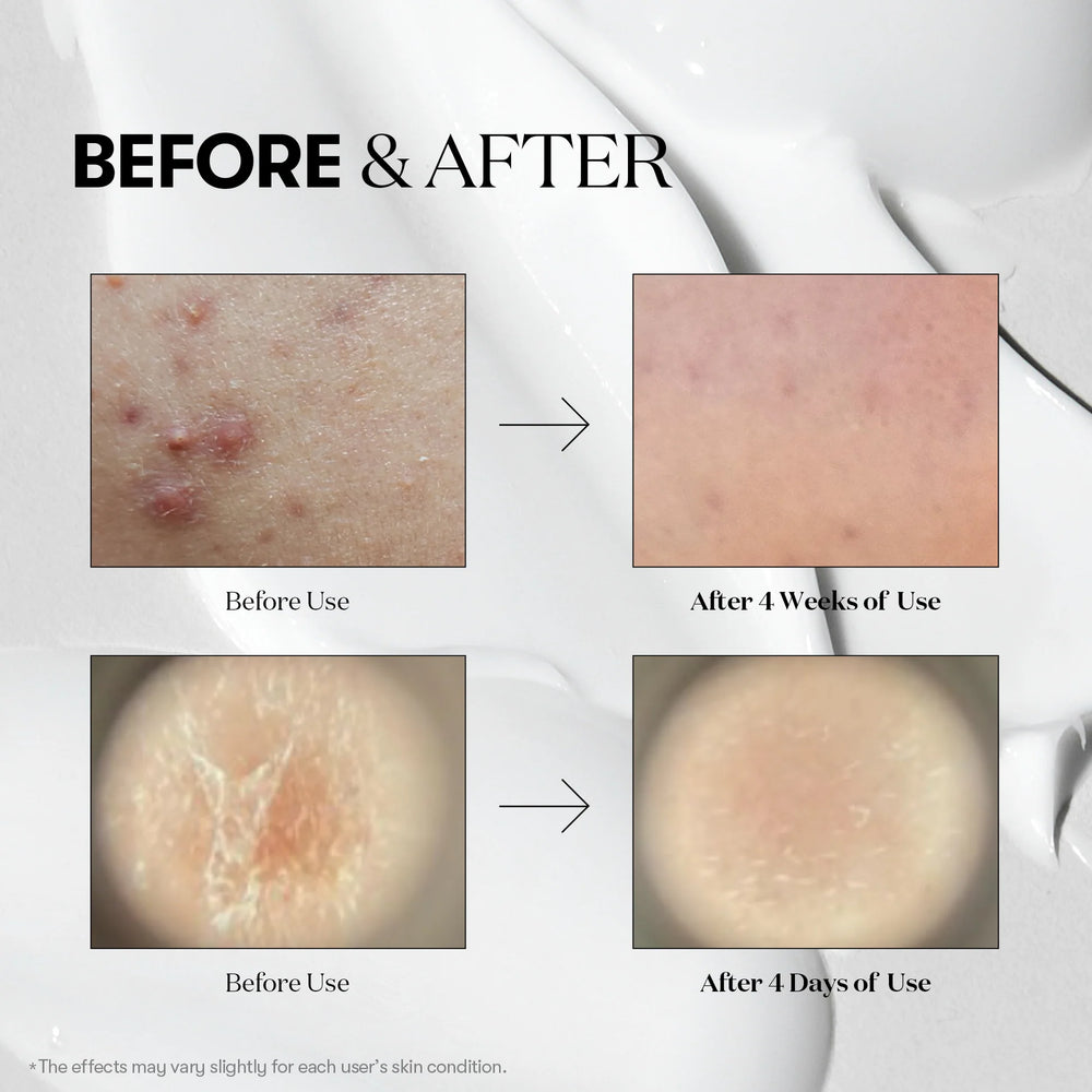 Cica Hyalon Reedle Shot 300 Essence 50ml detail