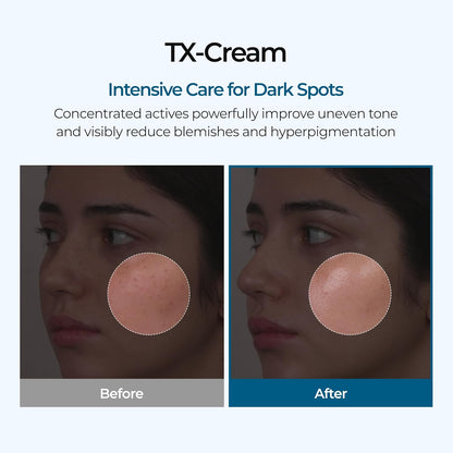 TX Cream