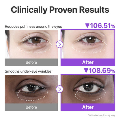 No.9 NAD+ Collagen Under Eye Patches 0.28oz×5ea