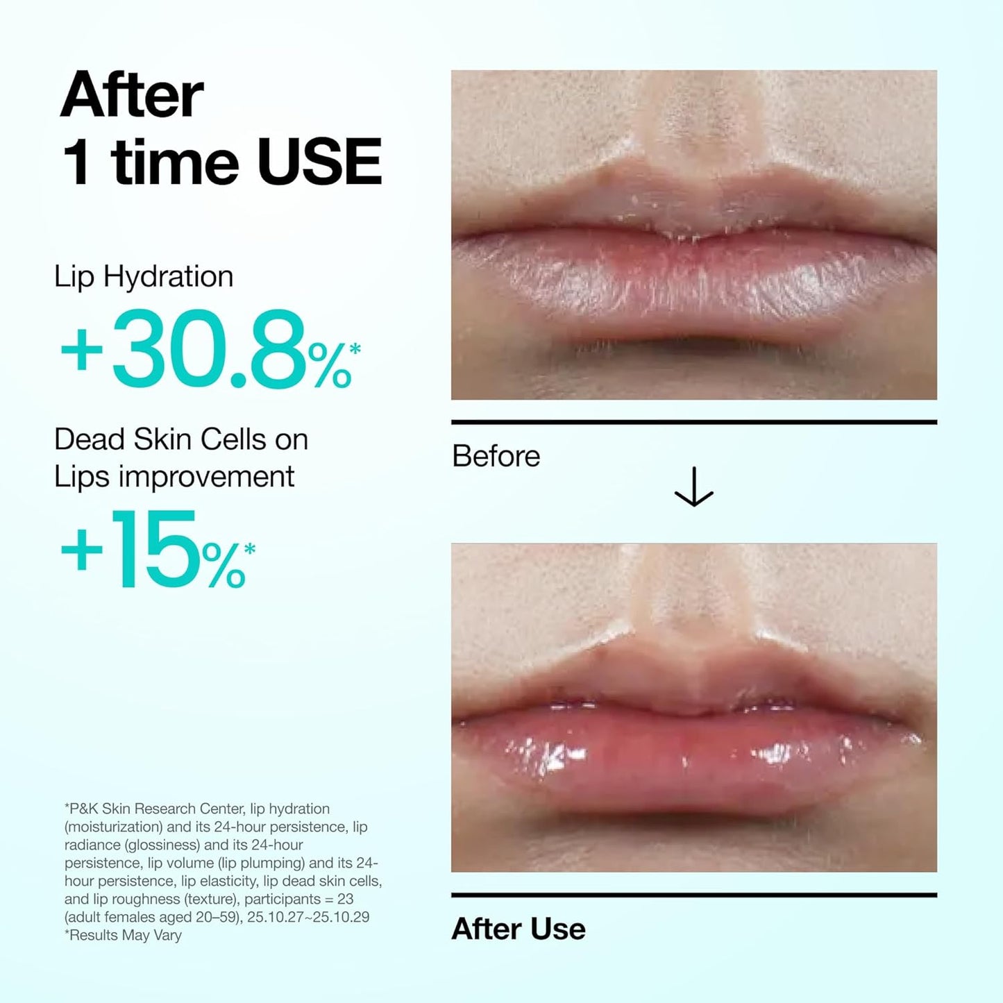 PDRN Lip Serum – 10ml