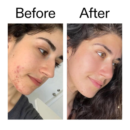 The Inkey List Succinic Acid Treatment 7
