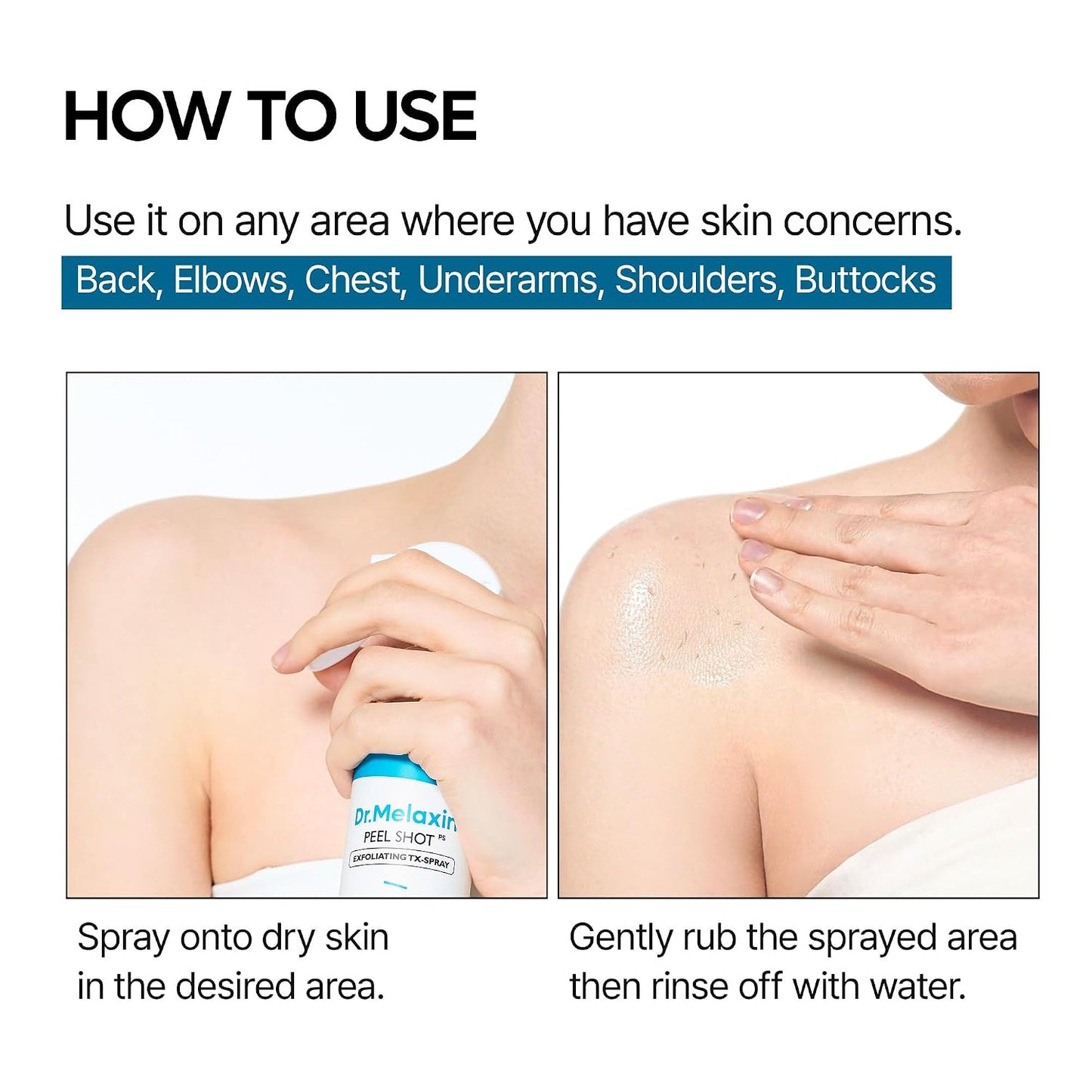 Peel Shot Exfoliating TX-Spray (Tranexamic Acid + Niacinamide) – 200ml