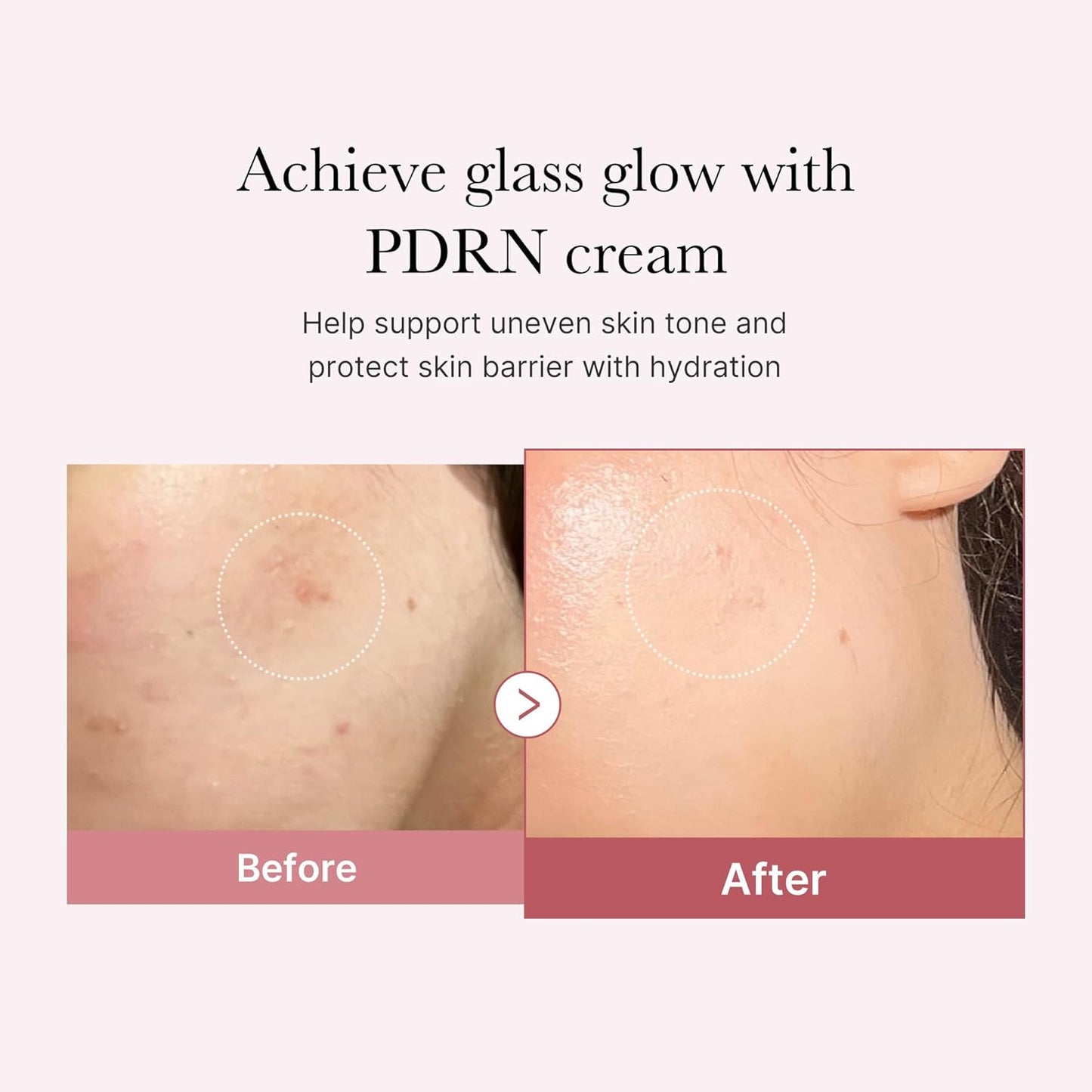 PDRN Pink Hyaluronic Moisturizing Cream - 50ml