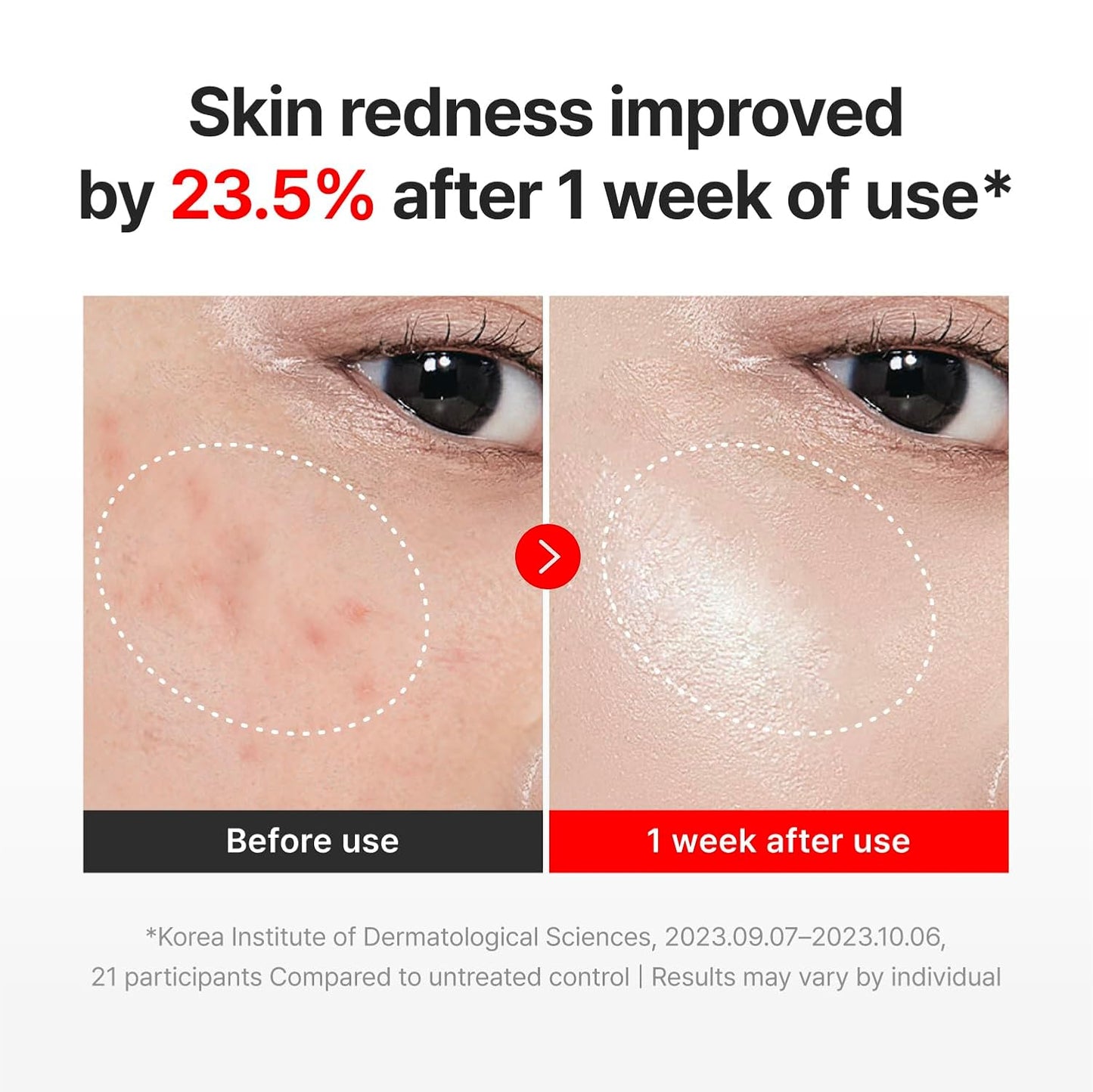 Centellian24 Madeca Cream Time Reverse 3