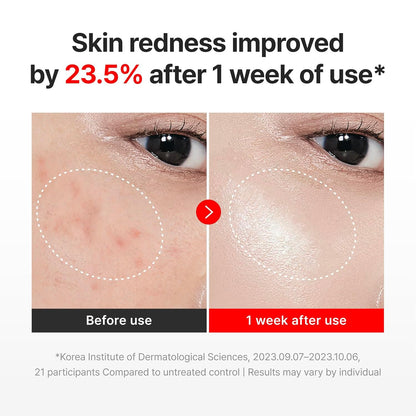 Centellian24 Madeca Cream Time Reverse 3