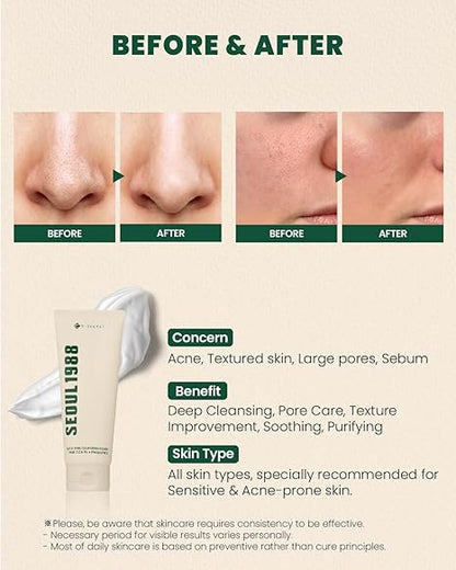 SEOUL 1988 cleansing Foam: Pine Cica 1% + Probiotics (150ml)