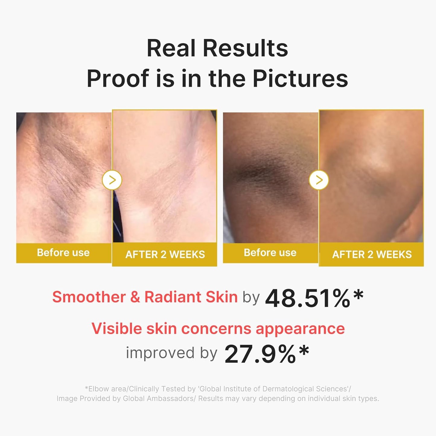 Kojic Acid Turmeric Body Peel Shot - 280ml