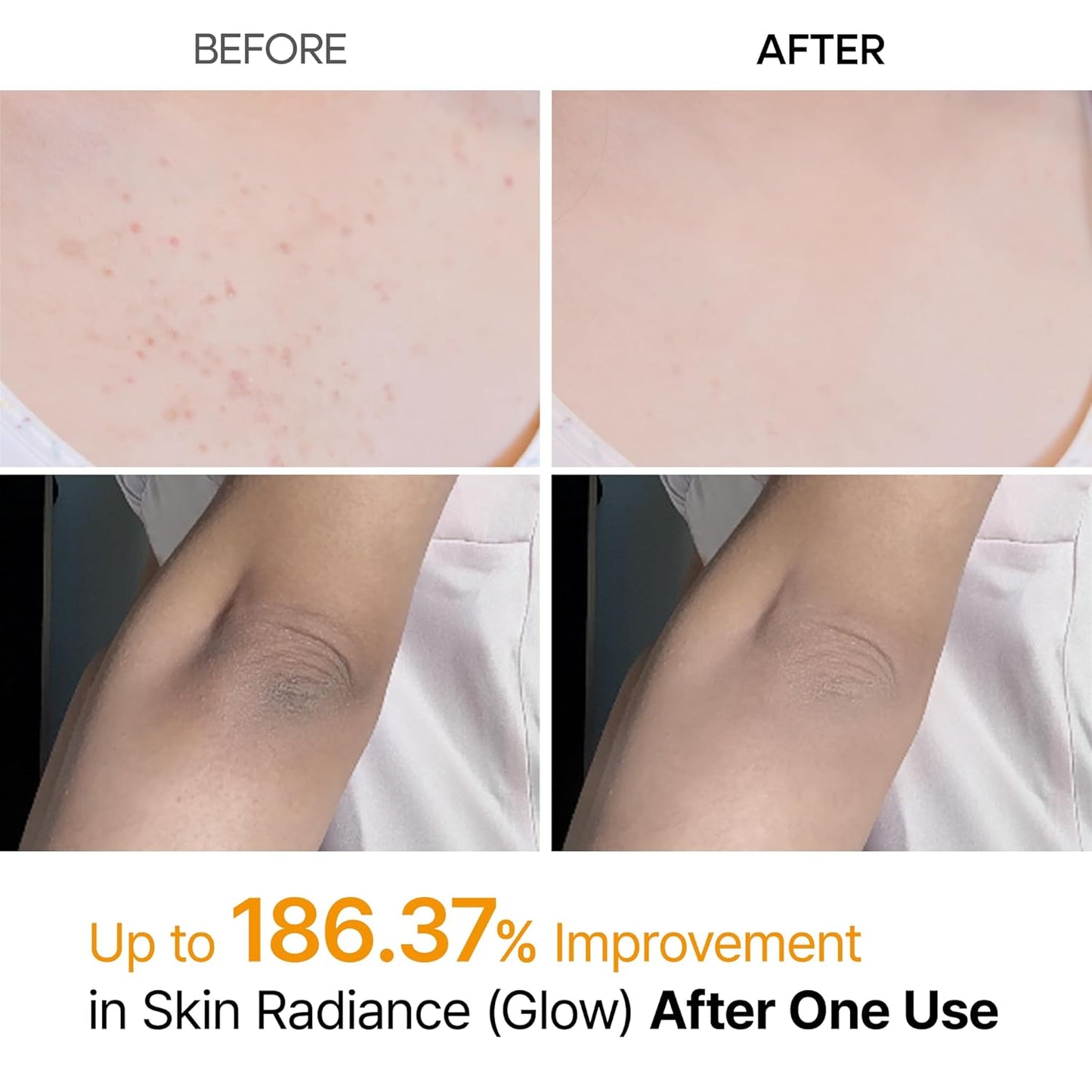 Peel Shot Exfoliating Kojic Acid Turmeric Spray 200ml