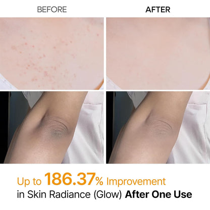 Peel Shot Exfoliating Kojic Acid Turmeric Spray 200ml