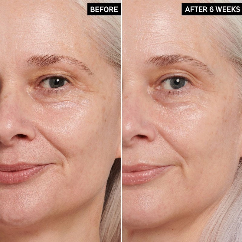Retinol Eye Cream 15ml