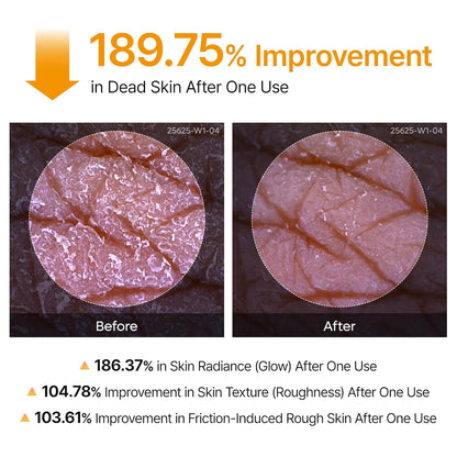 Peel Shot Exfoliating Kojic Acid Turmeric Spray 200ml