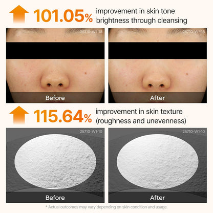 Peel Shot Exfoliating Kojic Acid Turmeric Serum – 80ml