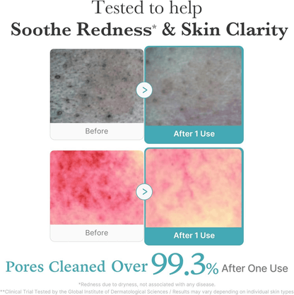 Azelaic Acid Niacinamide Deep Clean Foam Cleanser 120g
