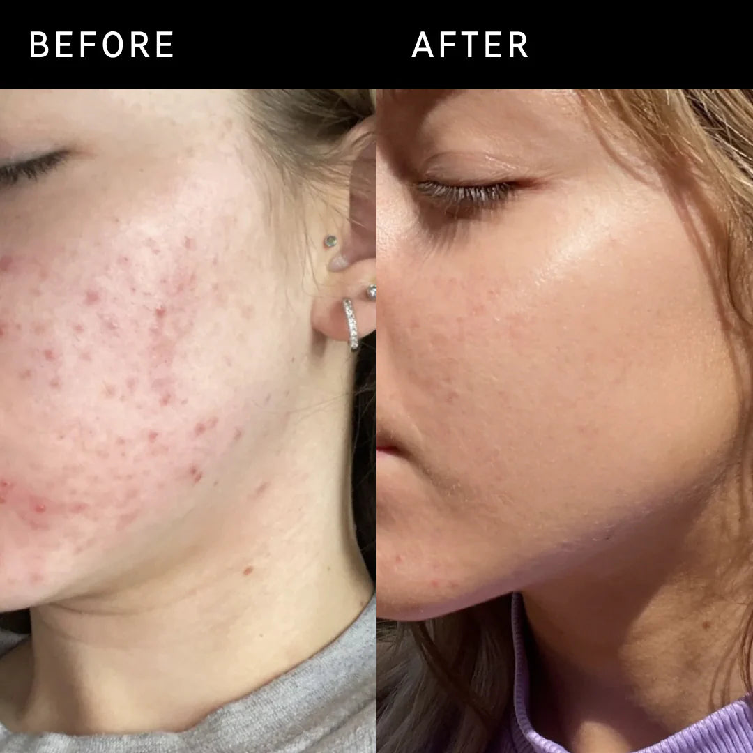 Niacinamide Serum