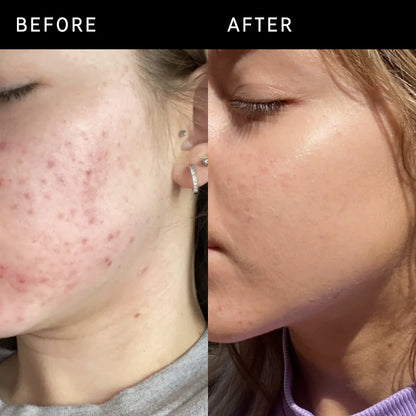 Niacinamide Serum