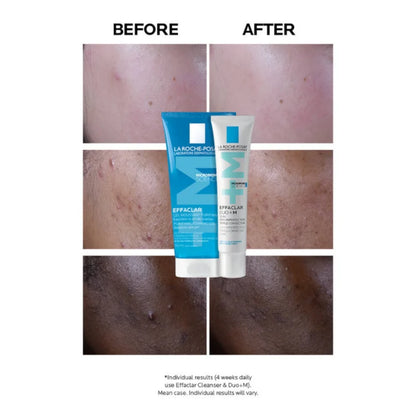 Effaclar Duo [+] Anti-Imperfections Treatment 40 mL ,