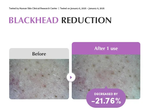 EQQUALBERRY - Purple Rice Pore Smoothing Cleansing Oil