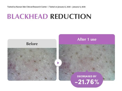 EQQUALBERRY - Purple Rice Pore Smoothing Cleansing Oil