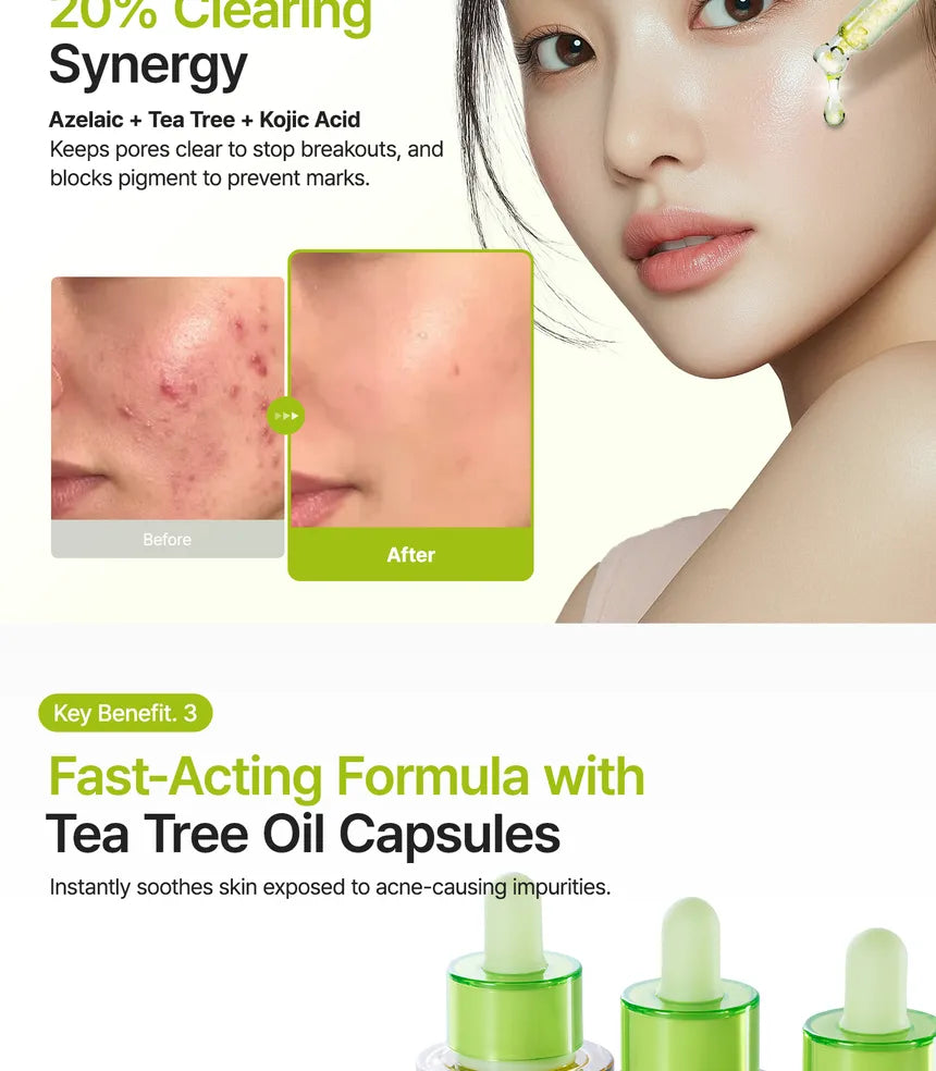 Purito SEOUL - Azelaic Acid 10 Kojic Tea Tree Serum