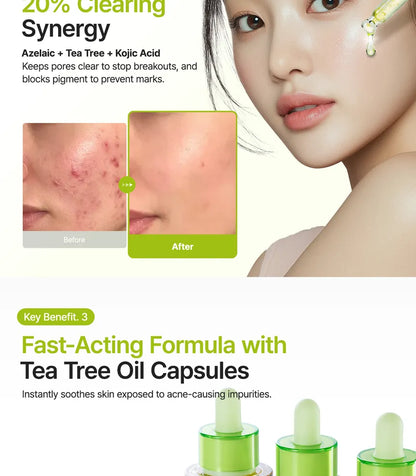 Purito SEOUL - Azelaic Acid 10 Kojic Tea Tree Serum