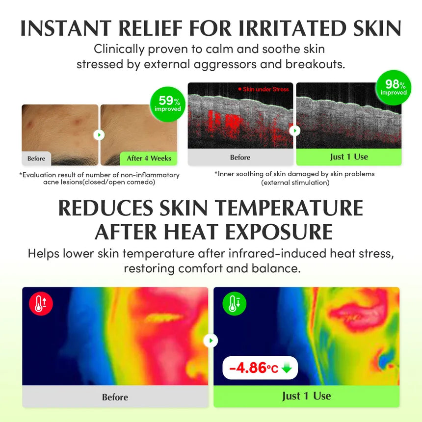 EQQUALBERRY - Aloe PDRN Calming Toner