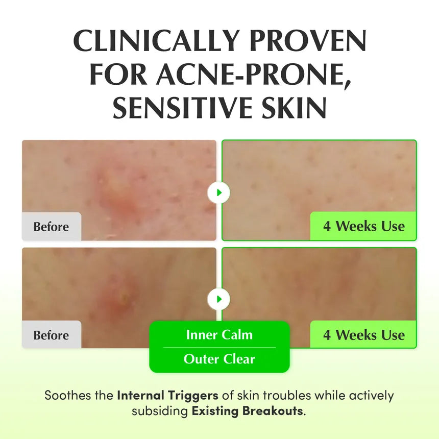 EQQUALBERRY - Aloe PDRN Calming Toner