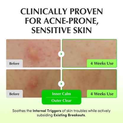 EQQUALBERRY - Aloe PDRN Calming Toner