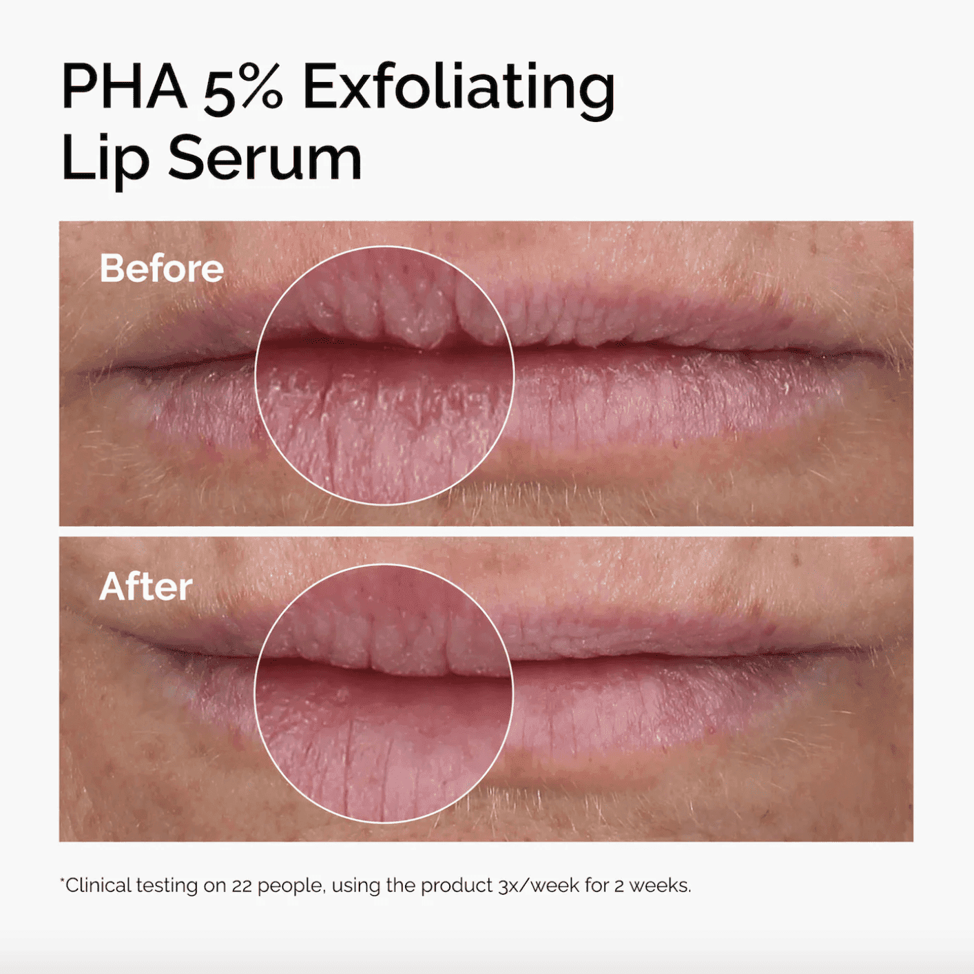 PHA 5% Exfoliating Lip Serum
