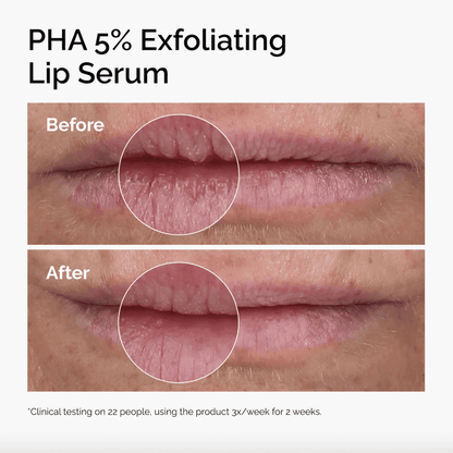 PHA 5% Exfoliating Lip Serum