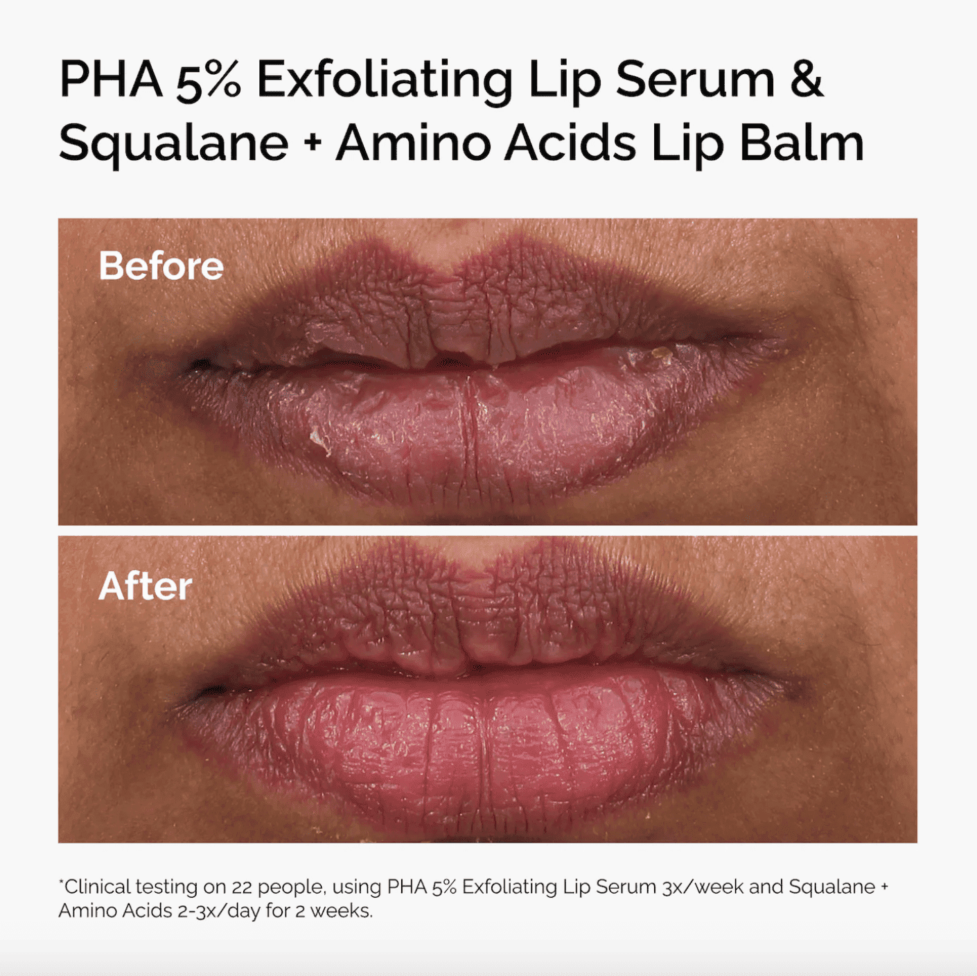 PHA 5% Exfoliating Lip Serum