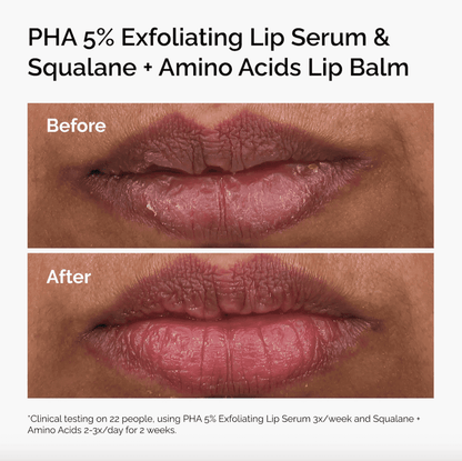 PHA 5% Exfoliating Lip Serum
